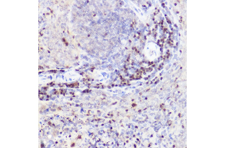 Immunohistochemistry - Anti-Ctip2 Antibody (A308272) - Antibodies.com