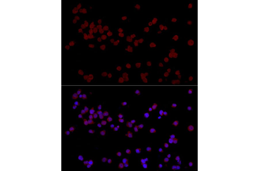 Immunofluorescence - Anti-Ctip2 Antibody (A308272) - Antibodies.com