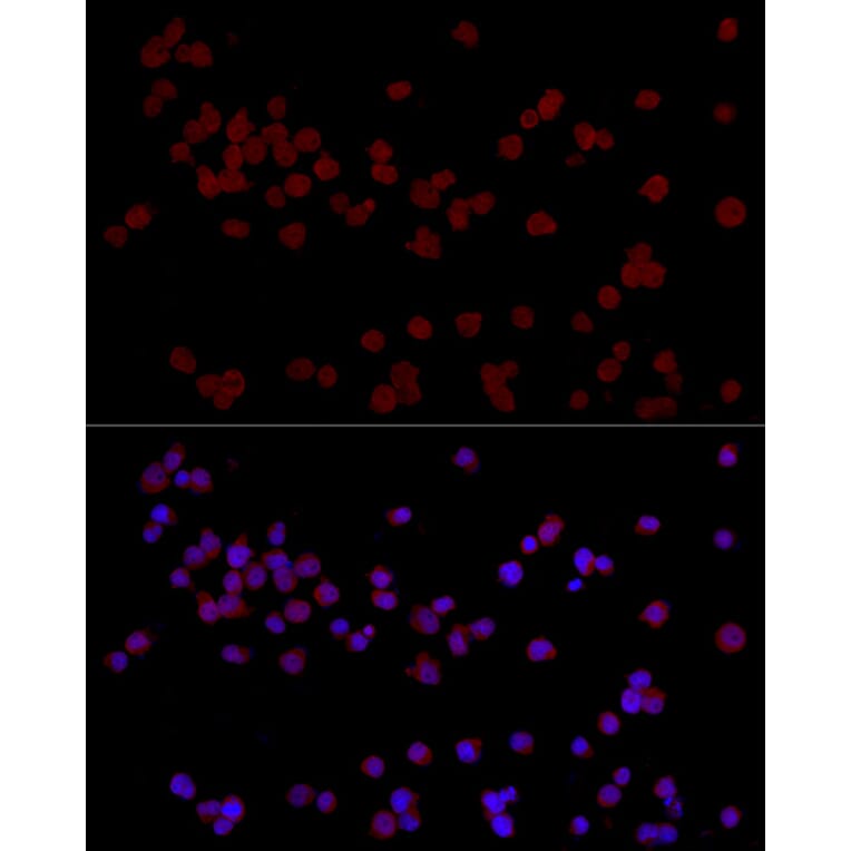 Immunofluorescence - Anti-Ctip2 Antibody (A308272) - Antibodies.com