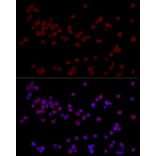 Immunofluorescence - Anti-Ctip2 Antibody (A308272) - Antibodies.com