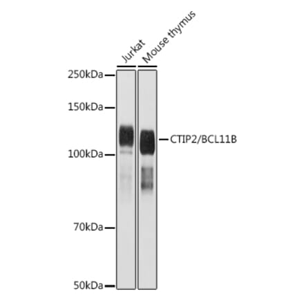 Western Blot - Anti-Ctip2 Antibody (A308273) - Antibodies.com
