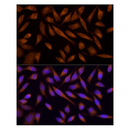 Immunofluorescence - Anti-AMPK alpha 1 Antibody (A308274) - Antibodies.com