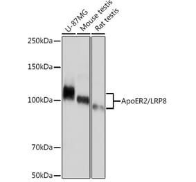 Western Blot - Anti-ApoER2 Antibody [ARC1730] (A308275) - Antibodies.com