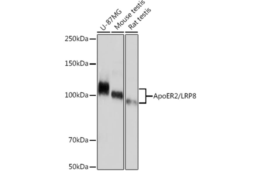 Western Blot - Anti-ApoER2 Antibody [ARC1730] (A308275) - Antibodies.com