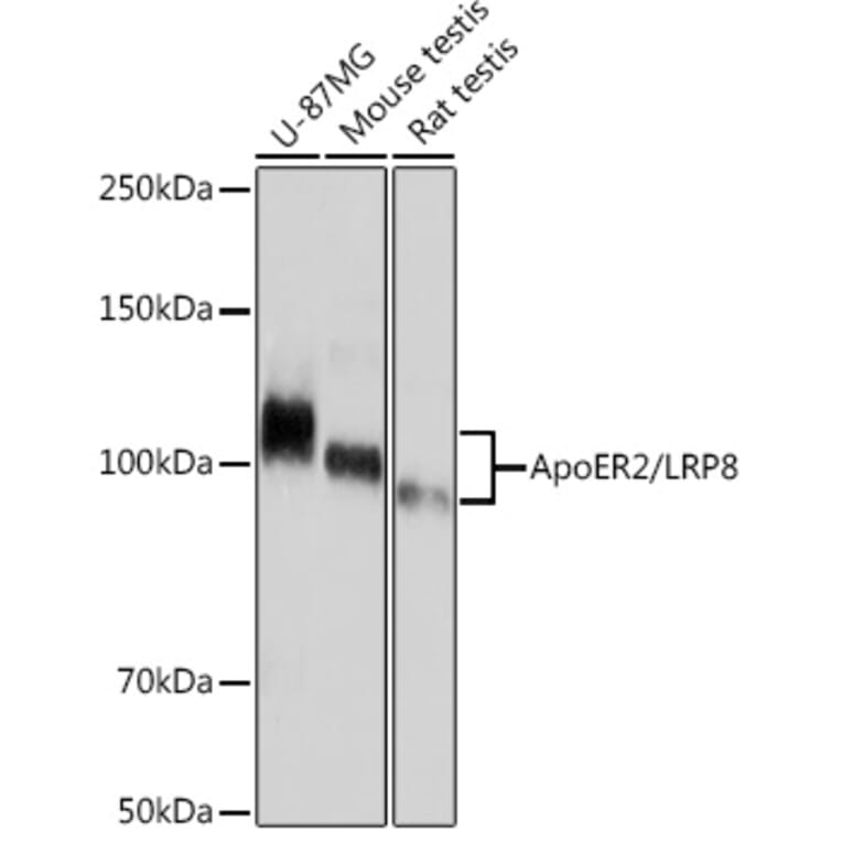 Western Blot - Anti-ApoER2 Antibody [ARC1730] (A308275) - Antibodies.com