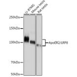 Western Blot - Anti-ApoER2 Antibody [ARC1730] (A308275) - Antibodies.com