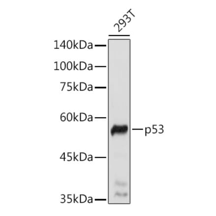 Western Blot - Anti-p53 Antibody (A308277) - Antibodies.com