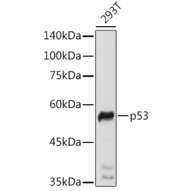 Western Blot - Anti-p53 Antibody (A308277) - Antibodies.com