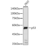 Western Blot - Anti-p53 Antibody (A308277) - Antibodies.com
