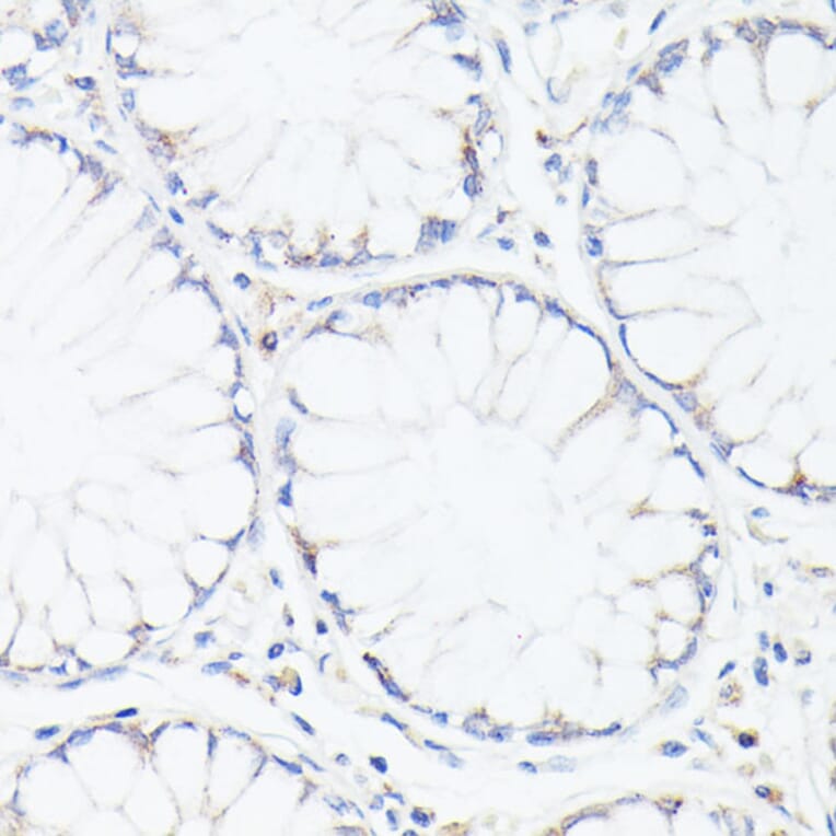 Immunohistochemistry - Anti-p53 Antibody (A308277) - Antibodies.com