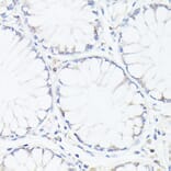 Immunohistochemistry - Anti-p53 Antibody (A308277) - Antibodies.com