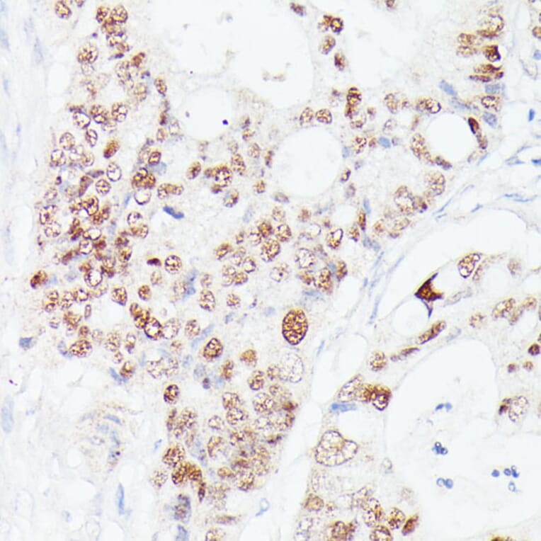 Immunohistochemistry - Anti-p53 Antibody (A308277) - Antibodies.com