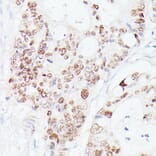 Immunohistochemistry - Anti-p53 Antibody (A308277) - Antibodies.com