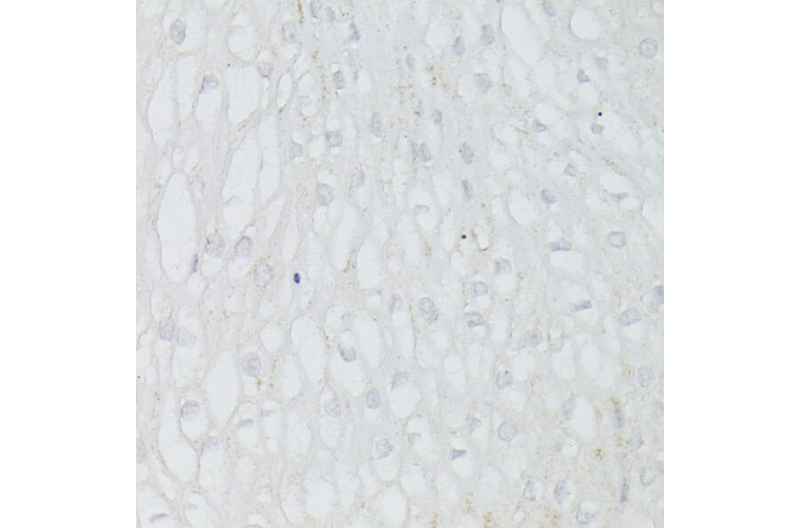 Immunohistochemistry - Anti-p53 Antibody (A308277) - Antibodies.com