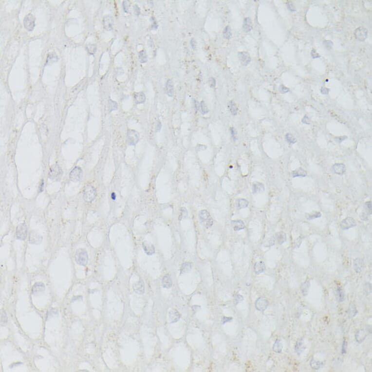 Immunohistochemistry - Anti-p53 Antibody (A308277) - Antibodies.com