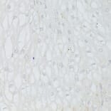 Immunohistochemistry - Anti-p53 Antibody (A308277) - Antibodies.com