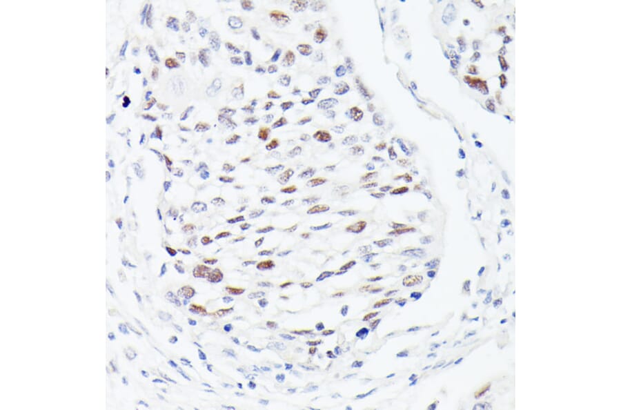 Immunohistochemistry - Anti-p53 Antibody (A308277) - Antibodies.com