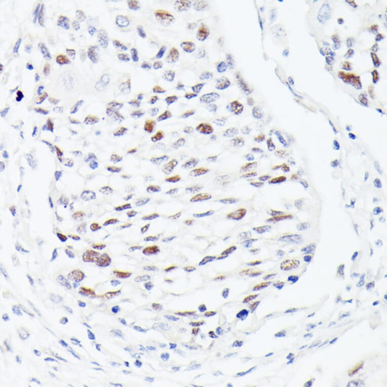 Immunohistochemistry - Anti-p53 Antibody (A308277) - Antibodies.com