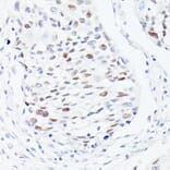 Immunohistochemistry - Anti-p53 Antibody (A308277) - Antibodies.com