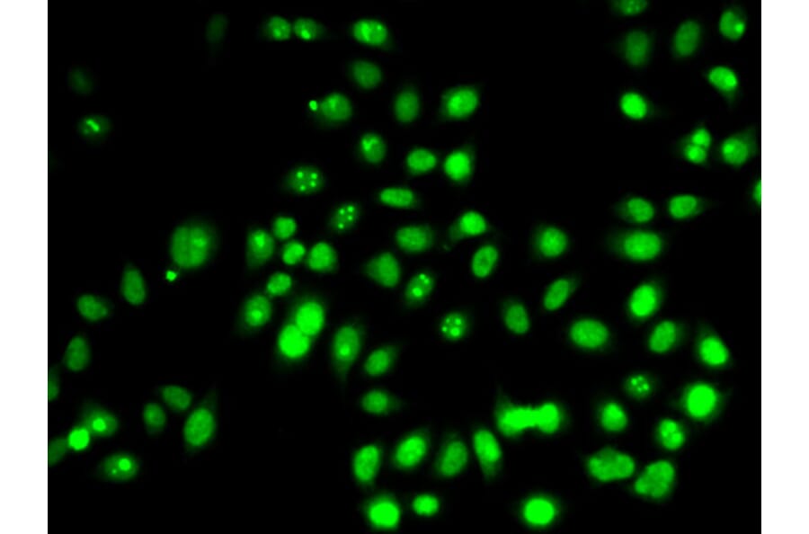 Immunofluorescence - Anti-p53 Antibody (A308277) - Antibodies.com
