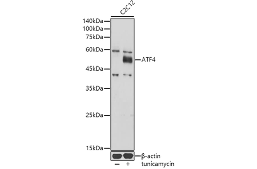 Western Blot - Anti-ATF-4 Antibody (A308278) - Antibodies.com