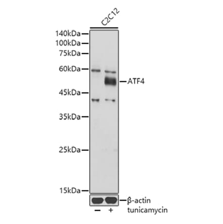 Western Blot - Anti-ATF-4 Antibody (A308278) - Antibodies.com