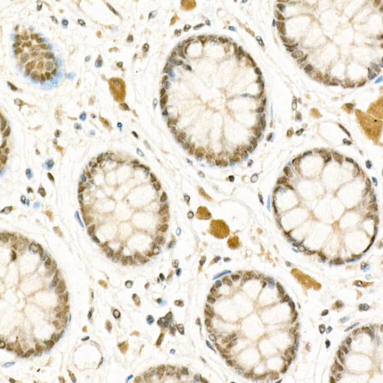 Immunohistochemistry - Anti-ATF-4 Antibody (A308278) - Antibodies.com