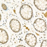 Immunohistochemistry - Anti-ATF-4 Antibody (A308278) - Antibodies.com
