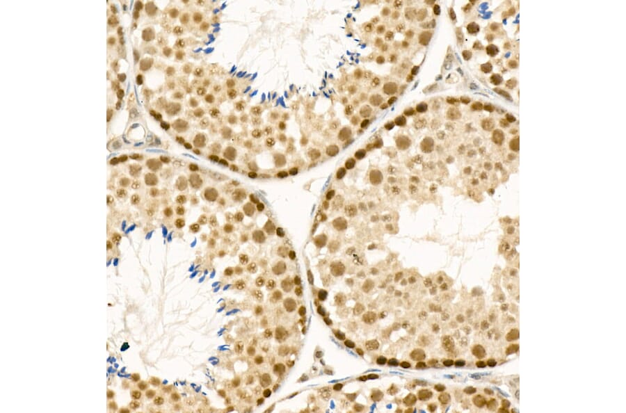 Immunohistochemistry - Anti-ATF-4 Antibody (A308278) - Antibodies.com