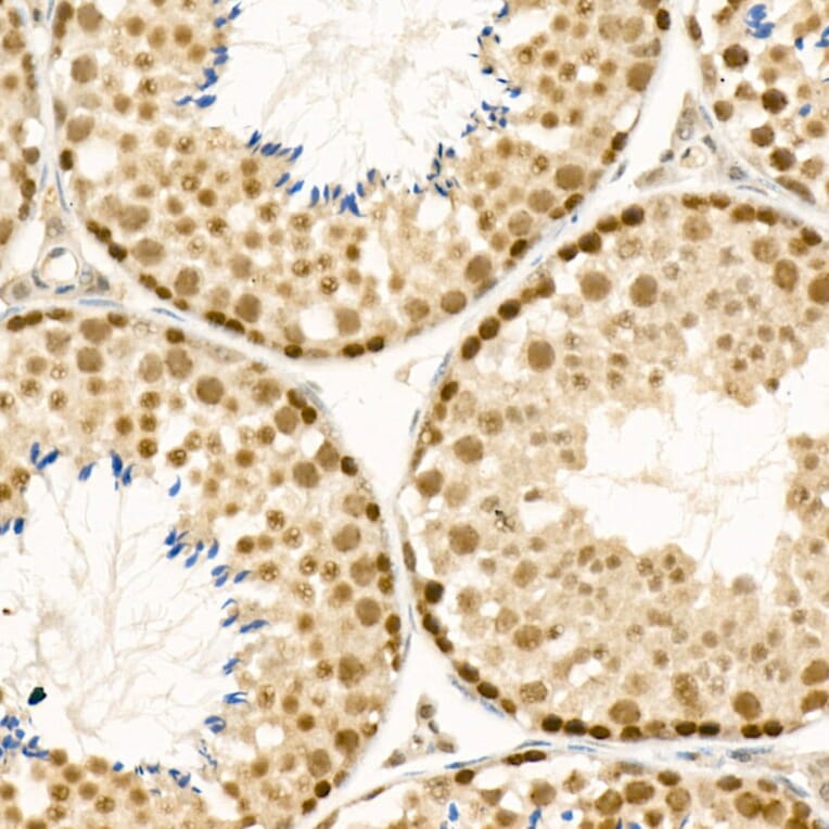 Immunohistochemistry - Anti-ATF-4 Antibody (A308278) - Antibodies.com