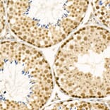 Immunohistochemistry - Anti-ATF-4 Antibody (A308278) - Antibodies.com