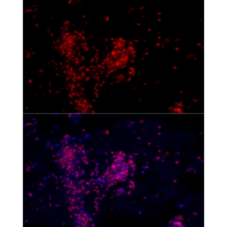 Immunofluorescence - Anti-ATF-4 Antibody (A308278) - Antibodies.com
