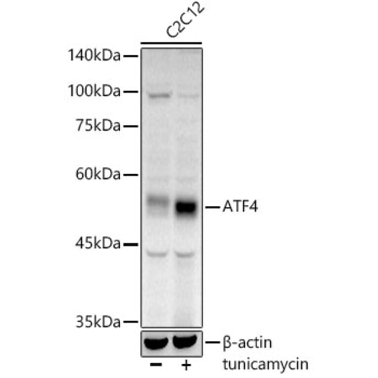 AntiATF4 Antibody (A308279)