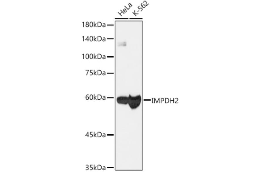 Western Blot - Anti-IMPDH2 Antibody [ARC1479] (A308284) - Antibodies.com