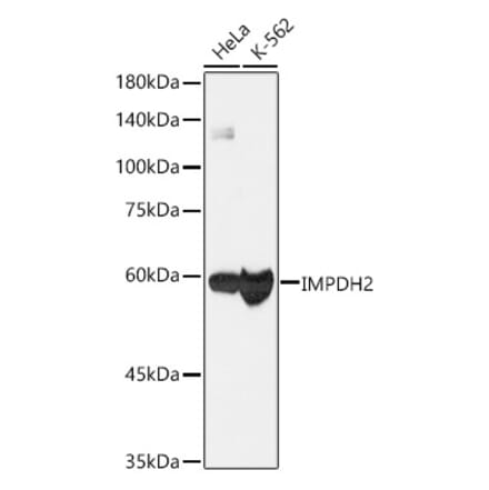 Western Blot - Anti-IMPDH2 Antibody [ARC1479] (A308284) - Antibodies.com