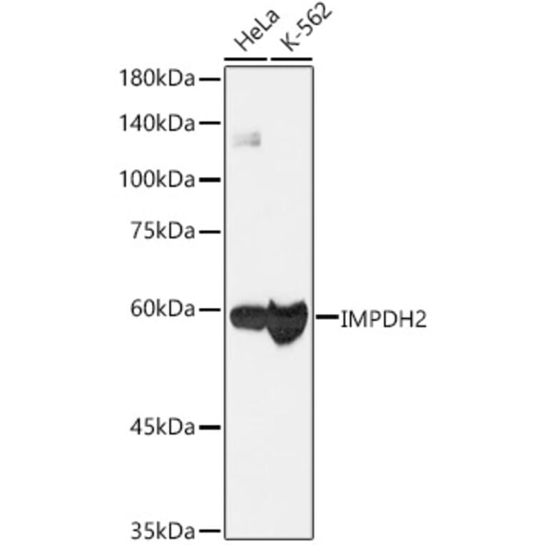 Western Blot - Anti-IMPDH2 Antibody [ARC1479] (A308284) - Antibodies.com