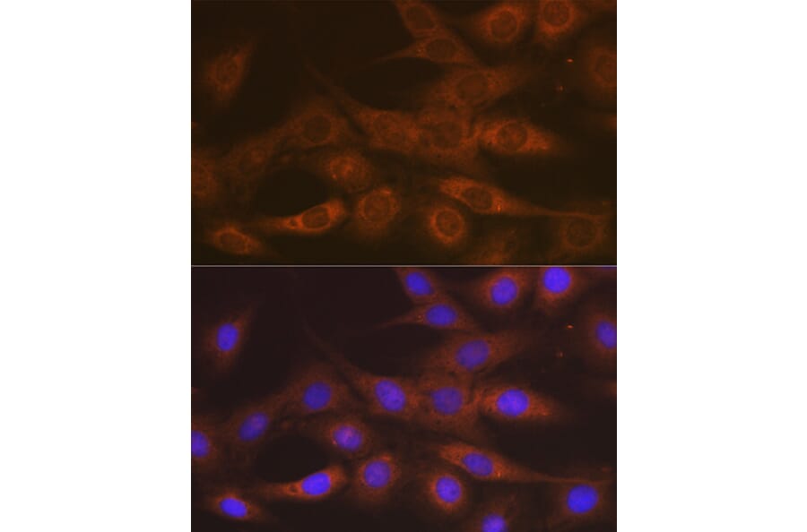 Immunofluorescence - Anti-IMPDH2 Antibody [ARC1479] (A308284) - Antibodies.com