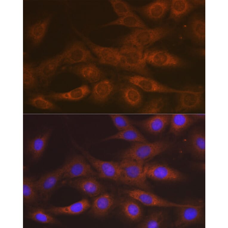 Immunofluorescence - Anti-IMPDH2 Antibody [ARC1479] (A308284) - Antibodies.com