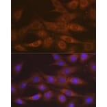 Immunofluorescence - Anti-IMPDH2 Antibody [ARC1479] (A308284) - Antibodies.com