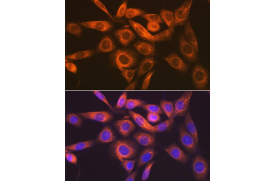 Immunofluorescence - Anti-IMPDH2 Antibody [ARC1479] (A308284) - Antibodies.com