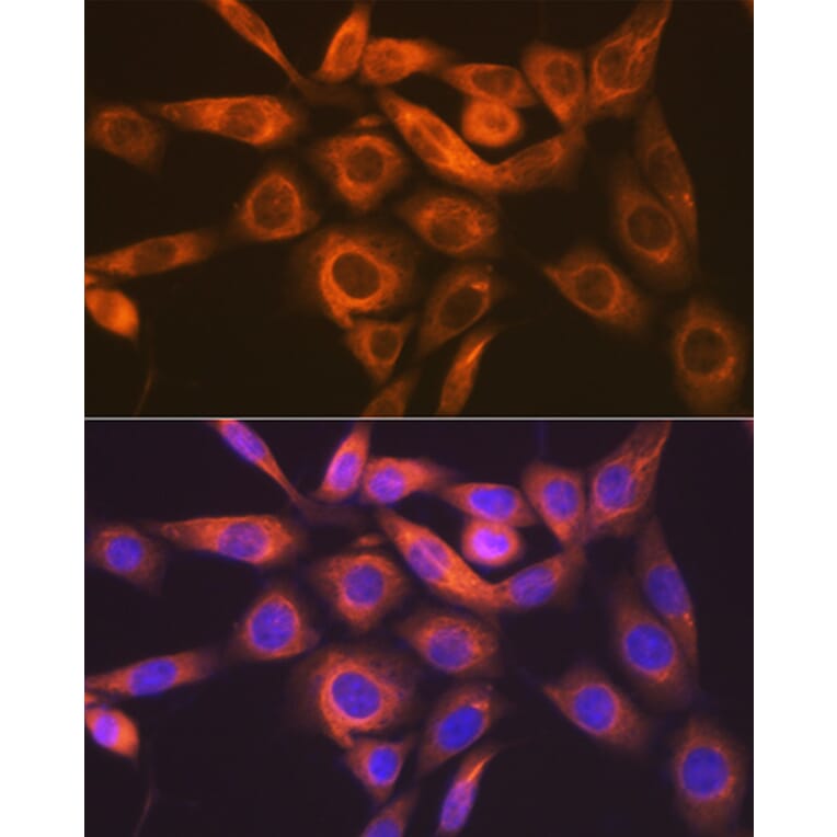 Immunofluorescence - Anti-IMPDH2 Antibody [ARC1479] (A308284) - Antibodies.com