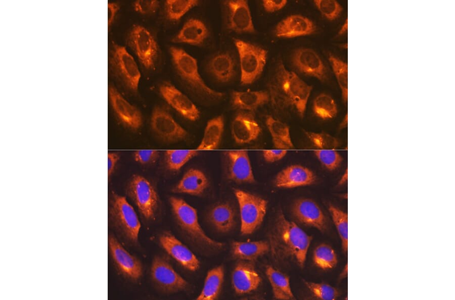 Immunofluorescence - Anti-IMPDH2 Antibody [ARC1479] (A308284) - Antibodies.com