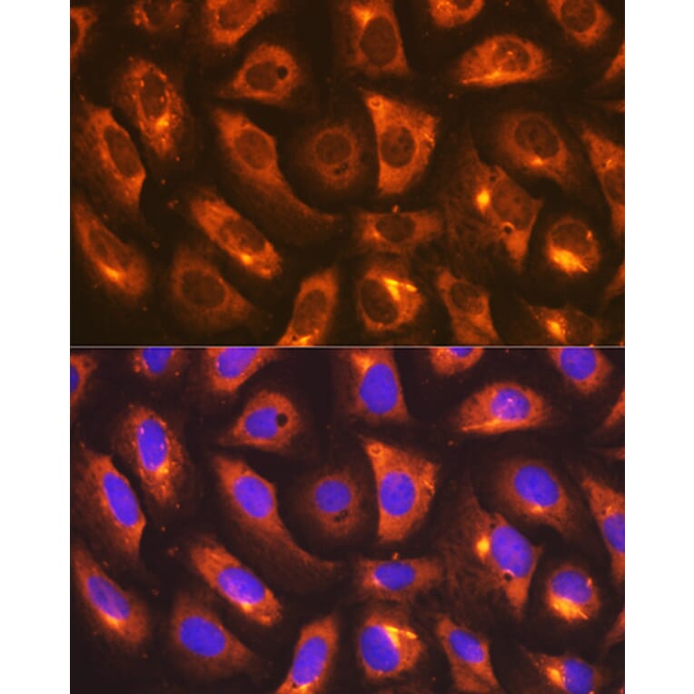 Immunofluorescence - Anti-IMPDH2 Antibody [ARC1479] (A308284) - Antibodies.com