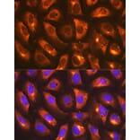 Immunofluorescence - Anti-IMPDH2 Antibody [ARC1479] (A308284) - Antibodies.com