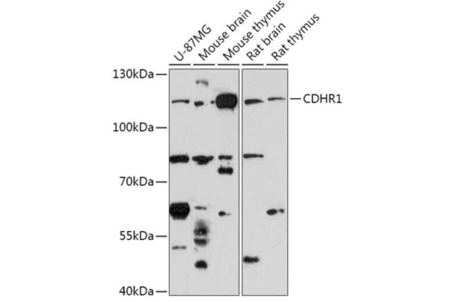 Western Blot - Anti-Protocadherin 21 Antibody (A308285) - Antibodies.com
