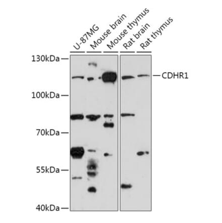 Western Blot - Anti-Protocadherin 21 Antibody (A308285) - Antibodies.com