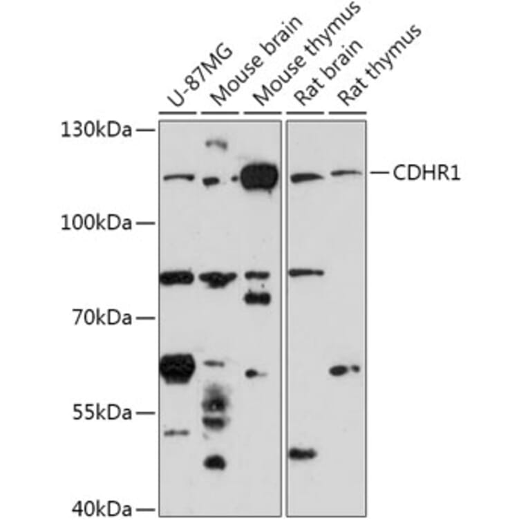 Western Blot - Anti-Protocadherin 21 Antibody (A308285) - Antibodies.com
