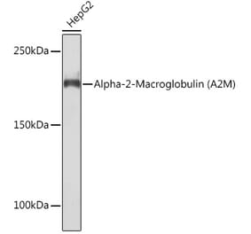 Western Blot - Anti-alpha 2 Macroglobulin Antibody [ARC1734] (A308286) - Antibodies.com
