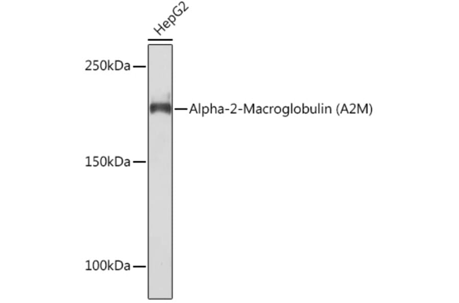 Western Blot - Anti-alpha 2 Macroglobulin Antibody [ARC1734] (A308286) - Antibodies.com