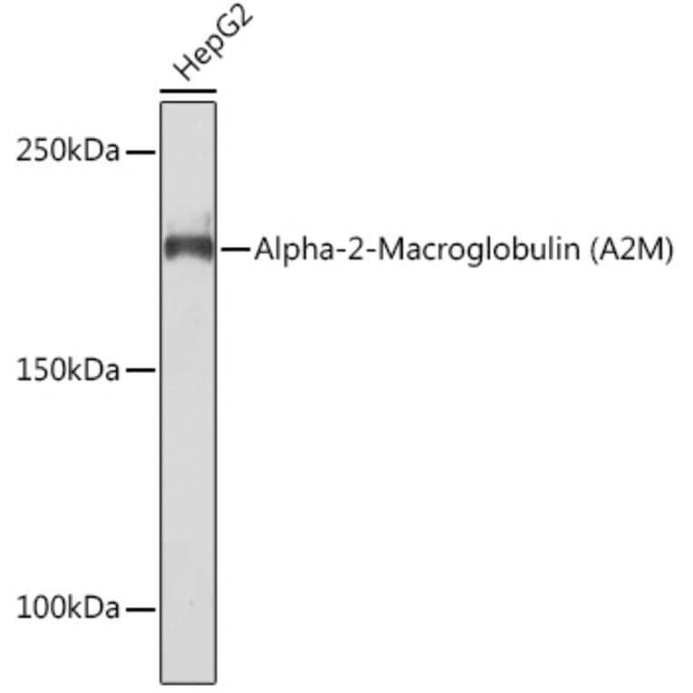 Western Blot - Anti-alpha 2 Macroglobulin Antibody [ARC1734] (A308286) - Antibodies.com